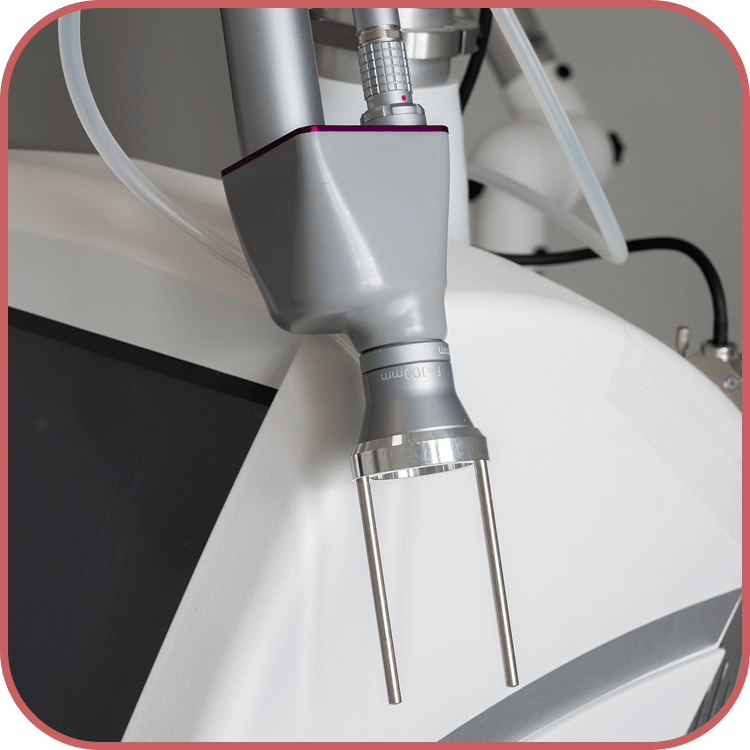 Nahaufnahme eines Handstücks eines medizinischen Lasers oder Derma-Behandlungsgeräts.